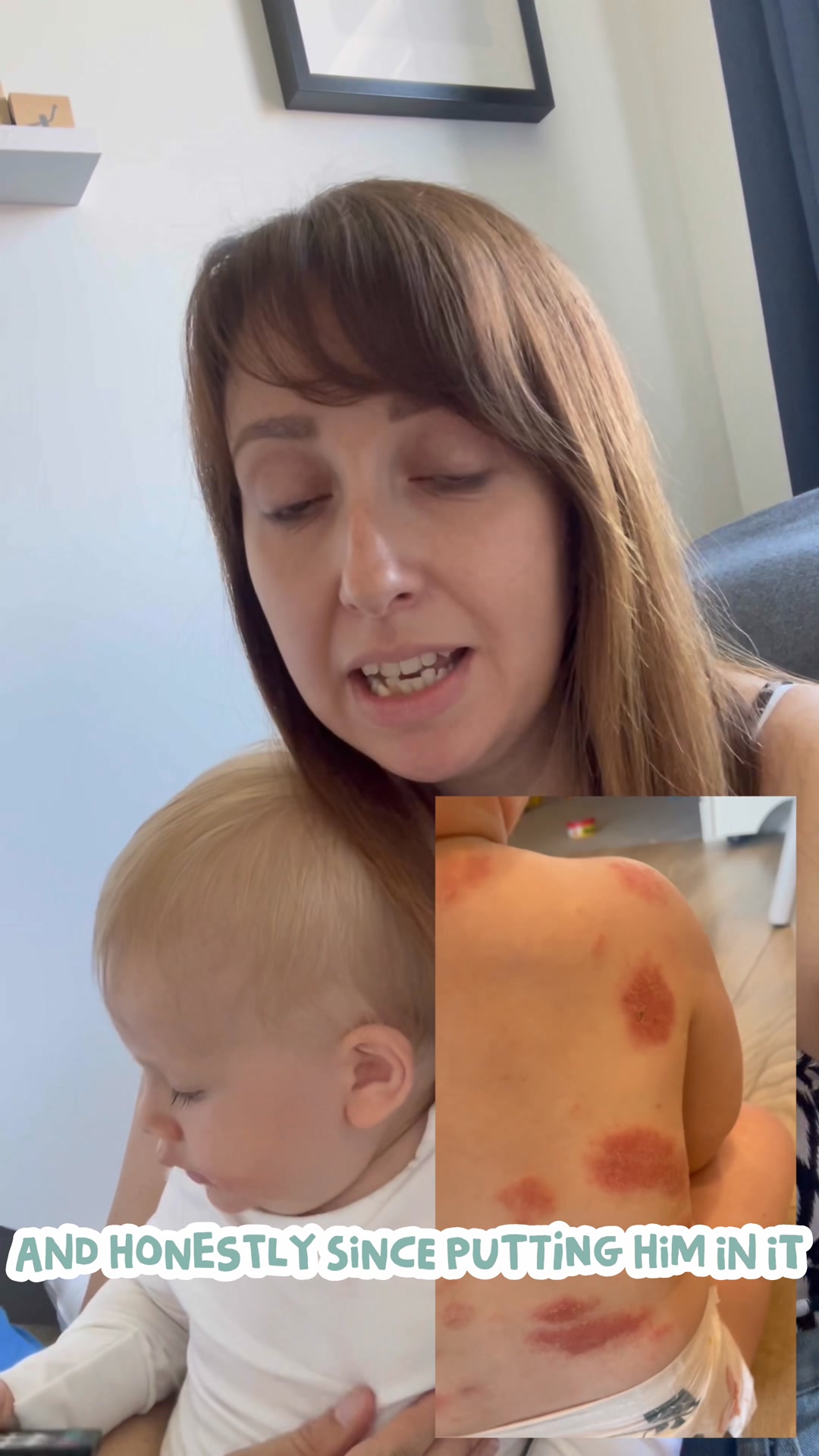 Lorna's Happy Skin Story