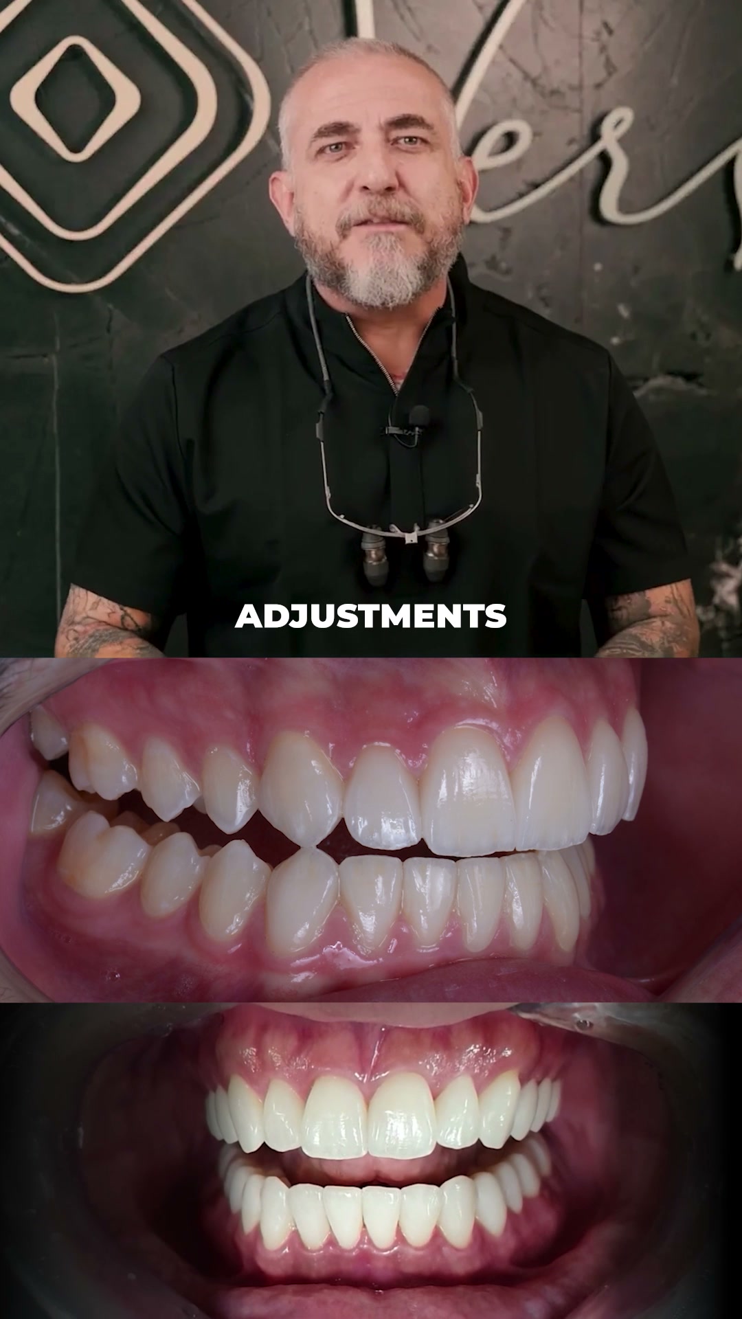 Master Occlusal Adjustments and Transform Your Clinical Results