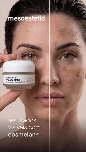 controlo de manchas com cosmelan® 2