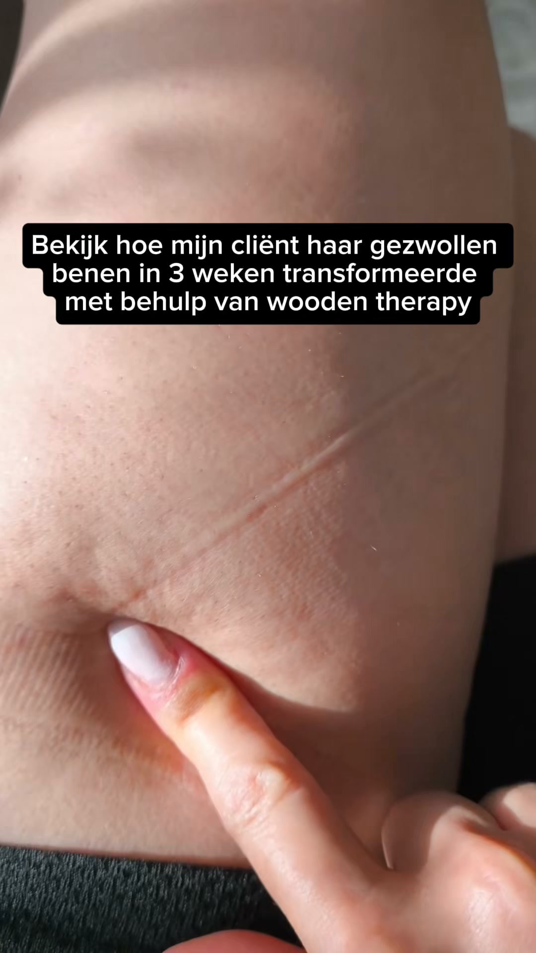 20.000+ verkocht