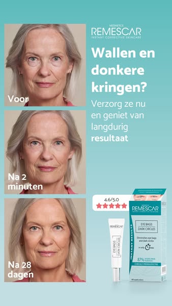 Shop nu voor langdurig resultaat.