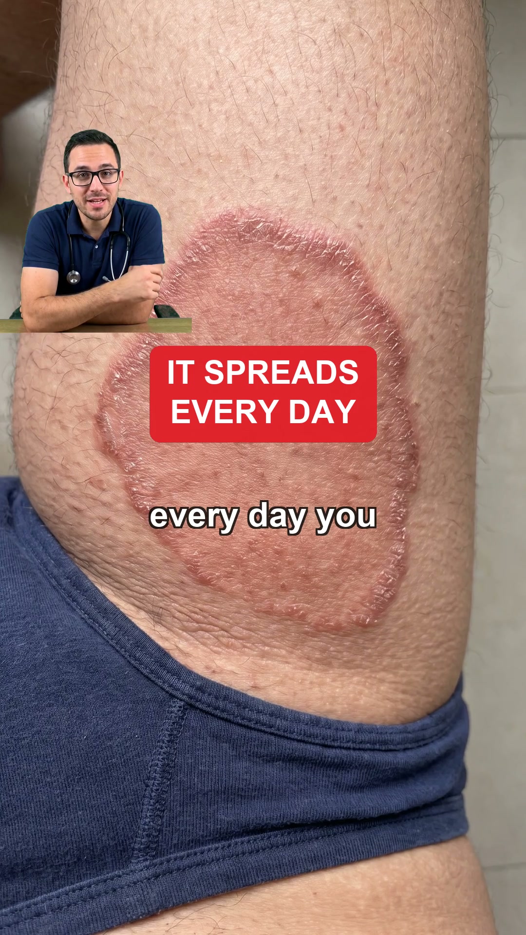 Itchy Balls? Stop The Itch In 60 Seconds