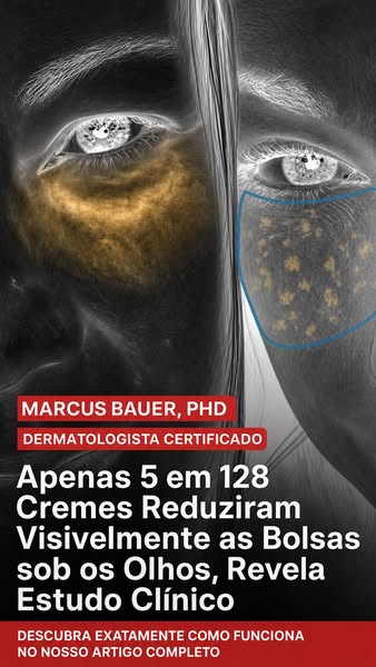 Apenas 5 em 128 Cremes Reduziram Visivelmente as Bolsas sob os Olhos, Revela Estudo Clínico