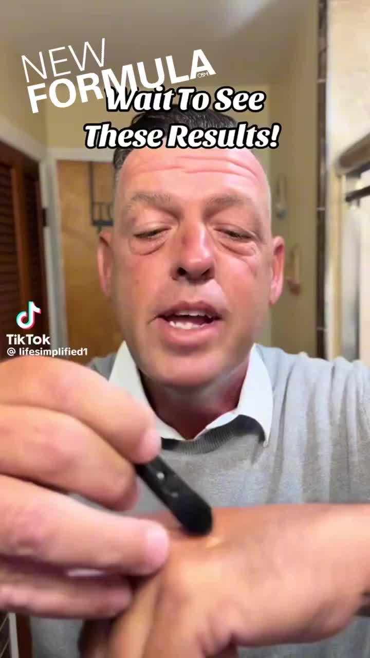 Anúncio de Adorease
