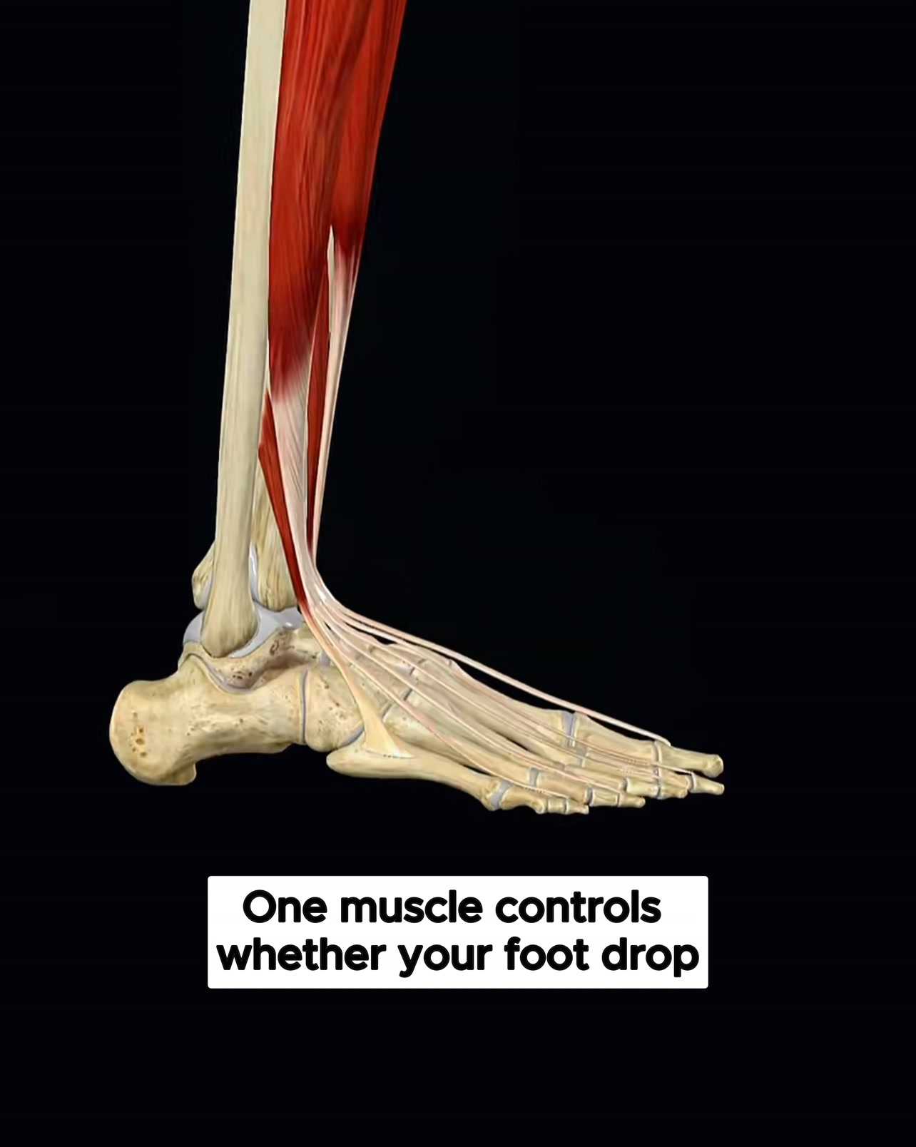 Every Foot Drop Treatment Failed For The Same Reason