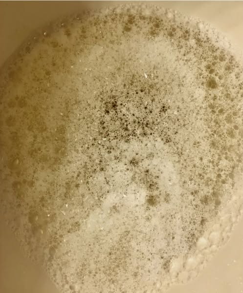 Foamy urine?