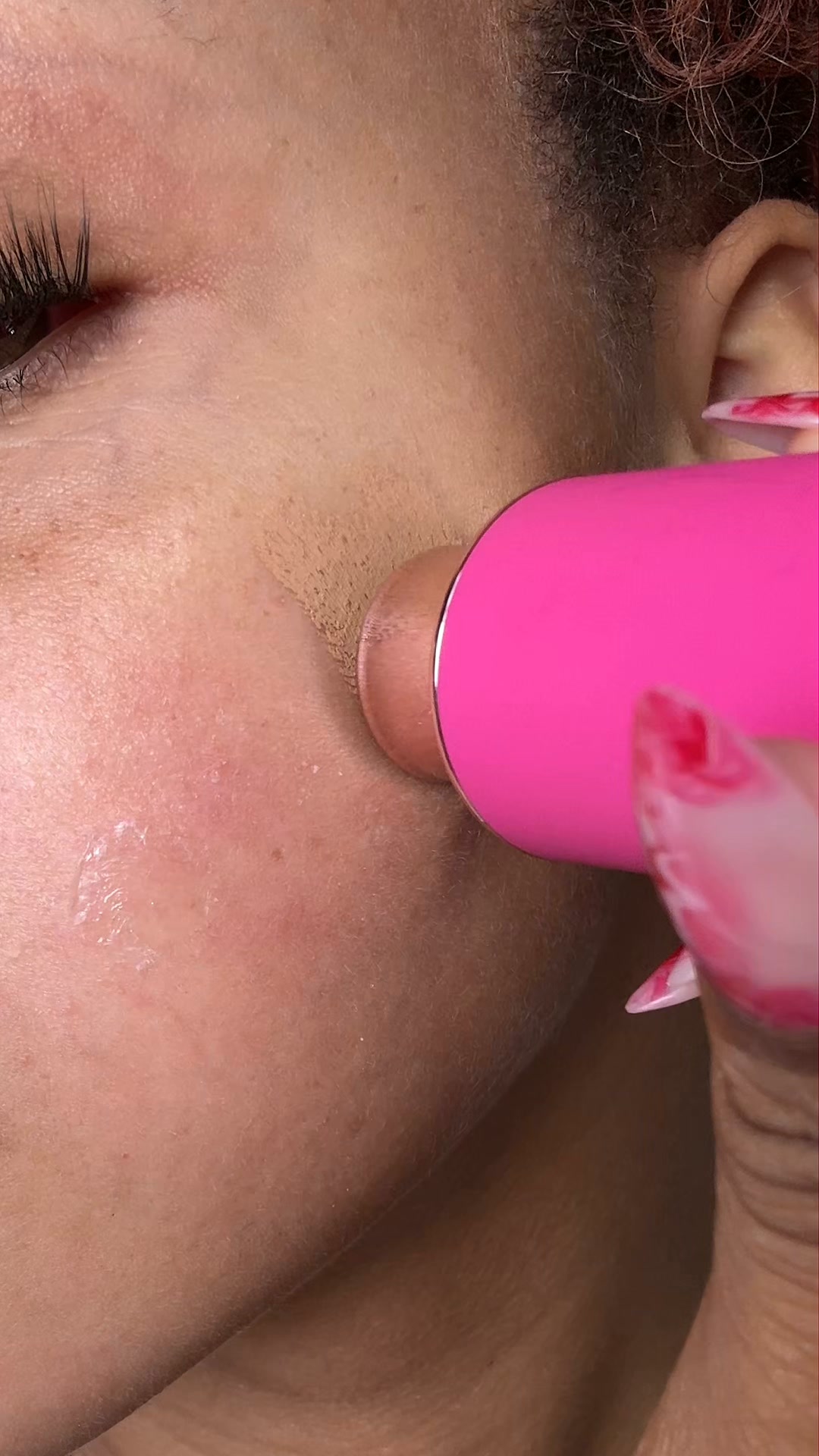 The Pimple Patch Nobody Has To Know About