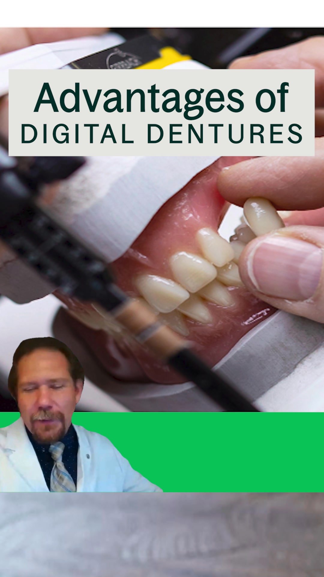 Webinar: 8 Tips for Perfect Dentures