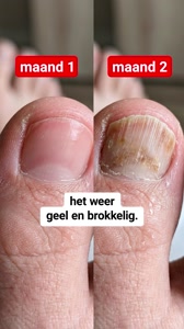 De precieze reden waarom Gezondheidsweek besloot Supplend onder de loep te nemen