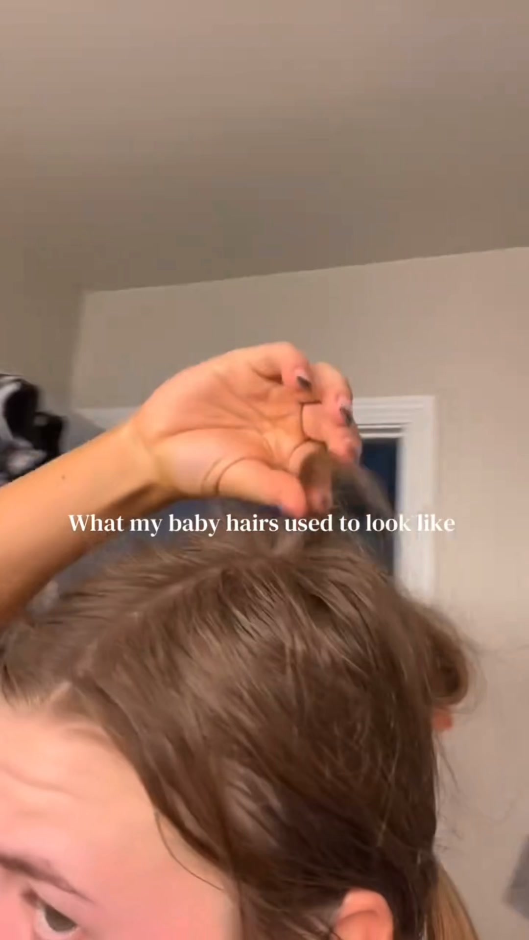 Korea's #1 Hair Growth Serum