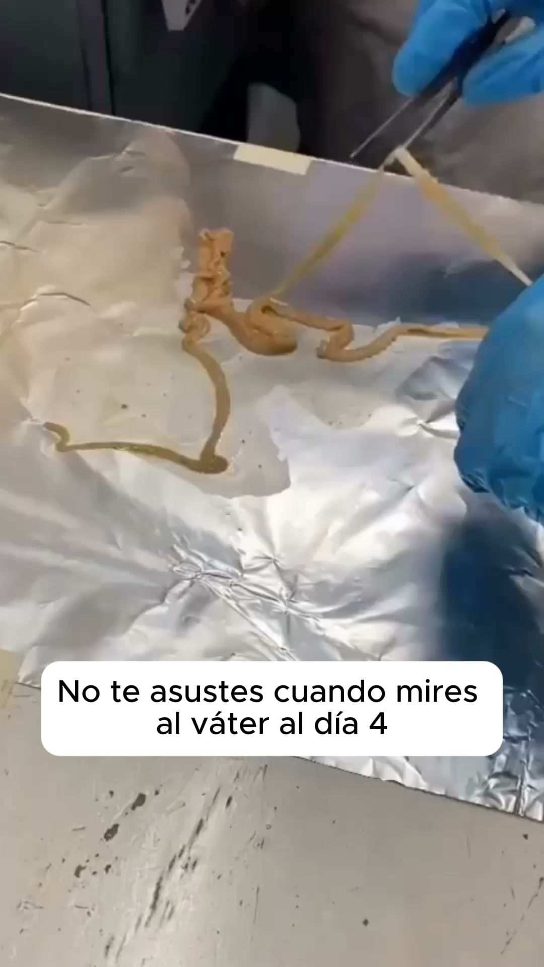 Un Huésped Le Robó Una Botella De Su Cabaña