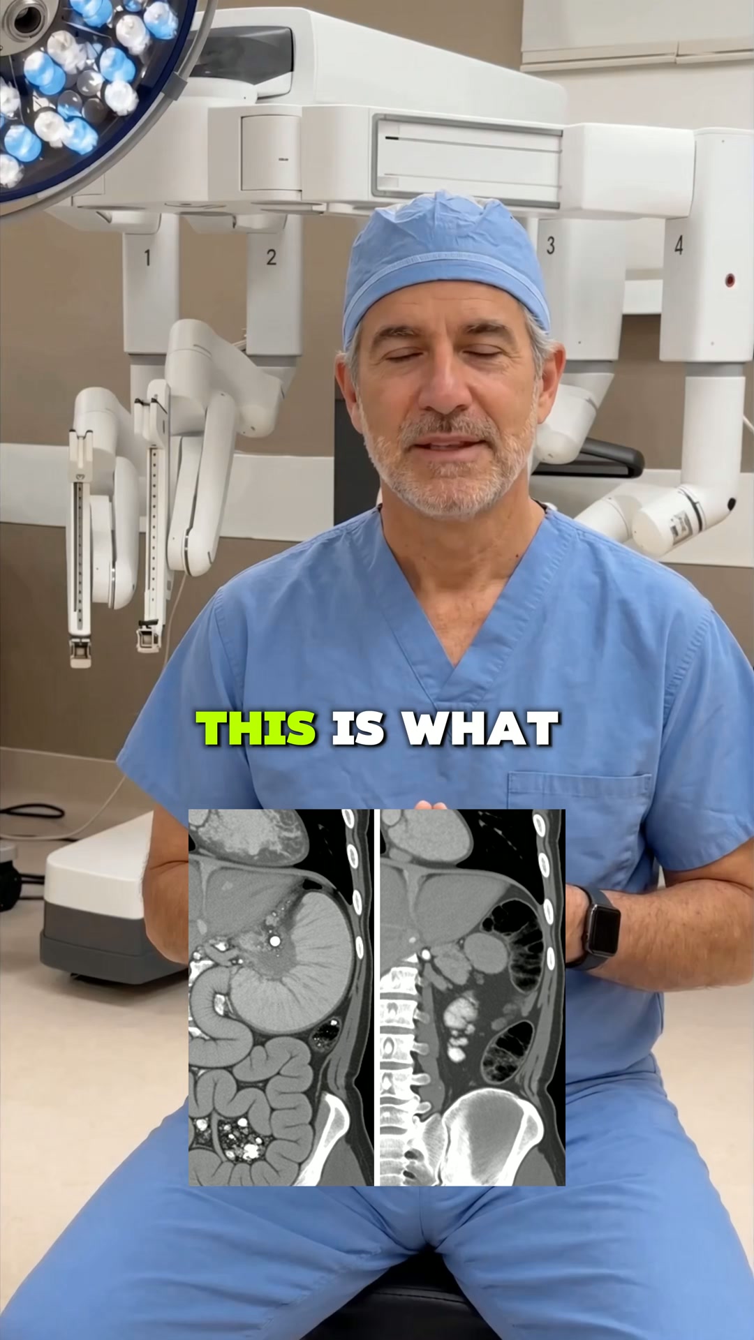 This Is A Bloated Stomach CT