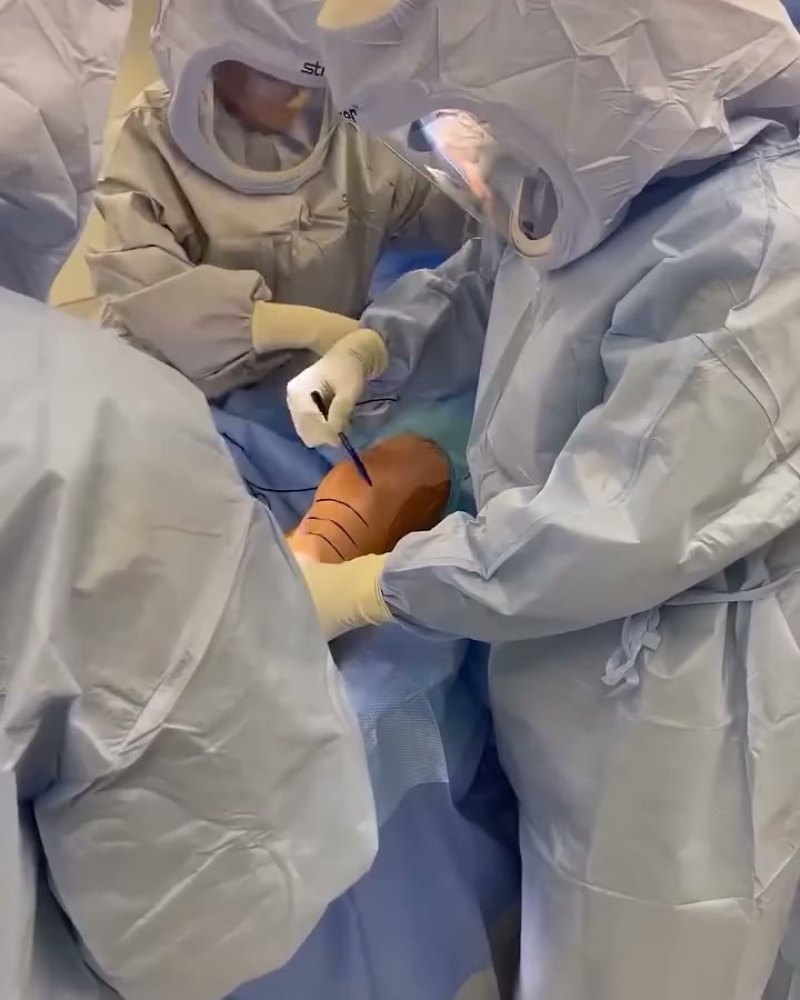 Try This Before You Book Surgery