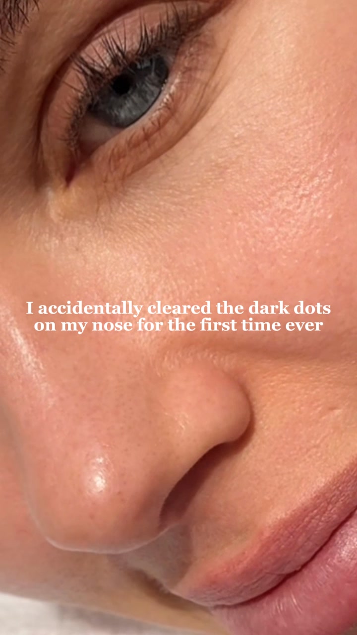 Clear Pores Overnight