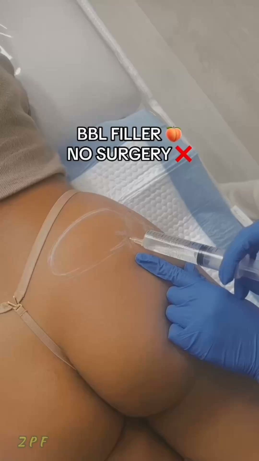 The Secret To Smoother-Looking Curves