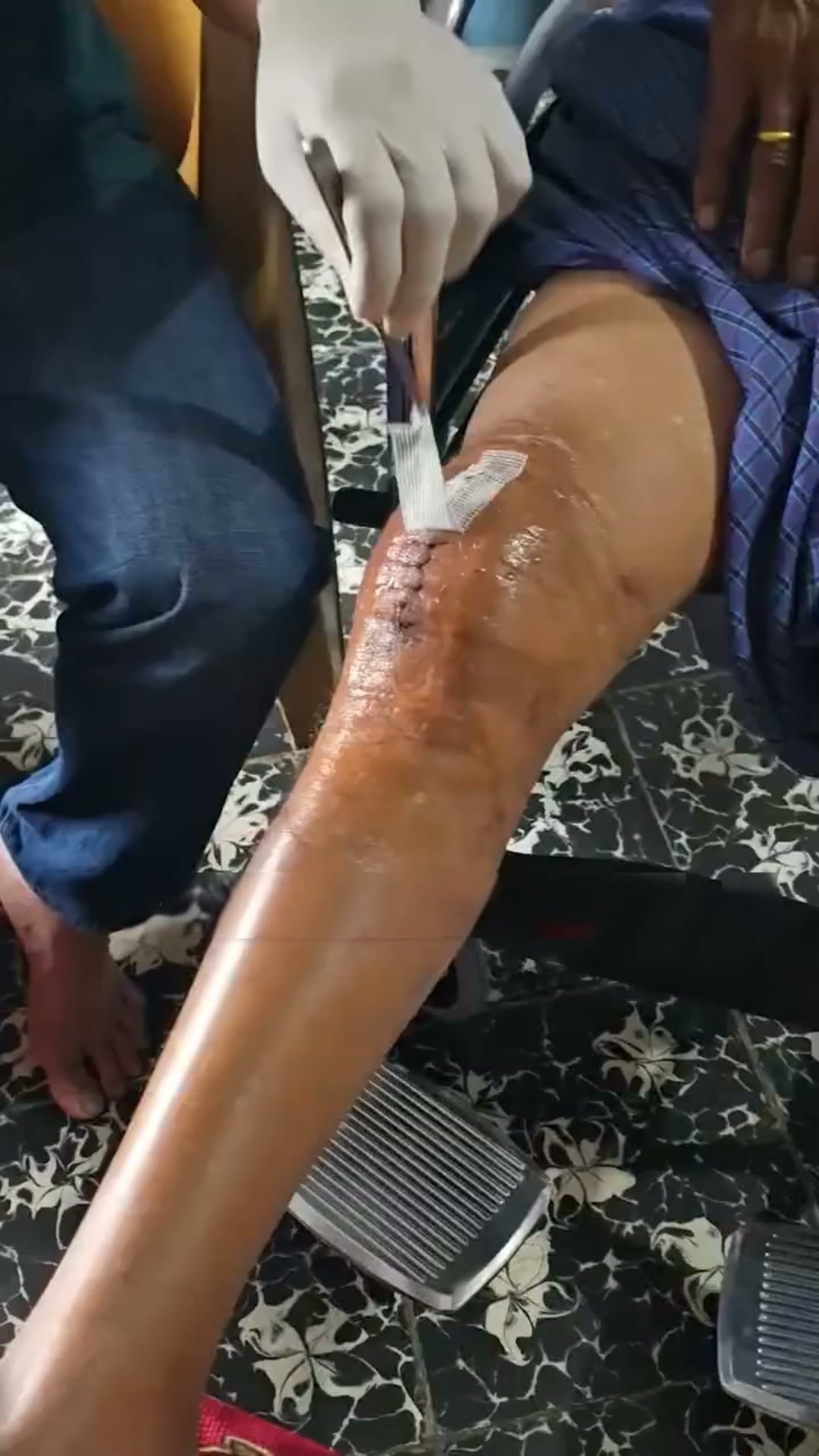 Retrouvez confort et stabilité à chaque pas