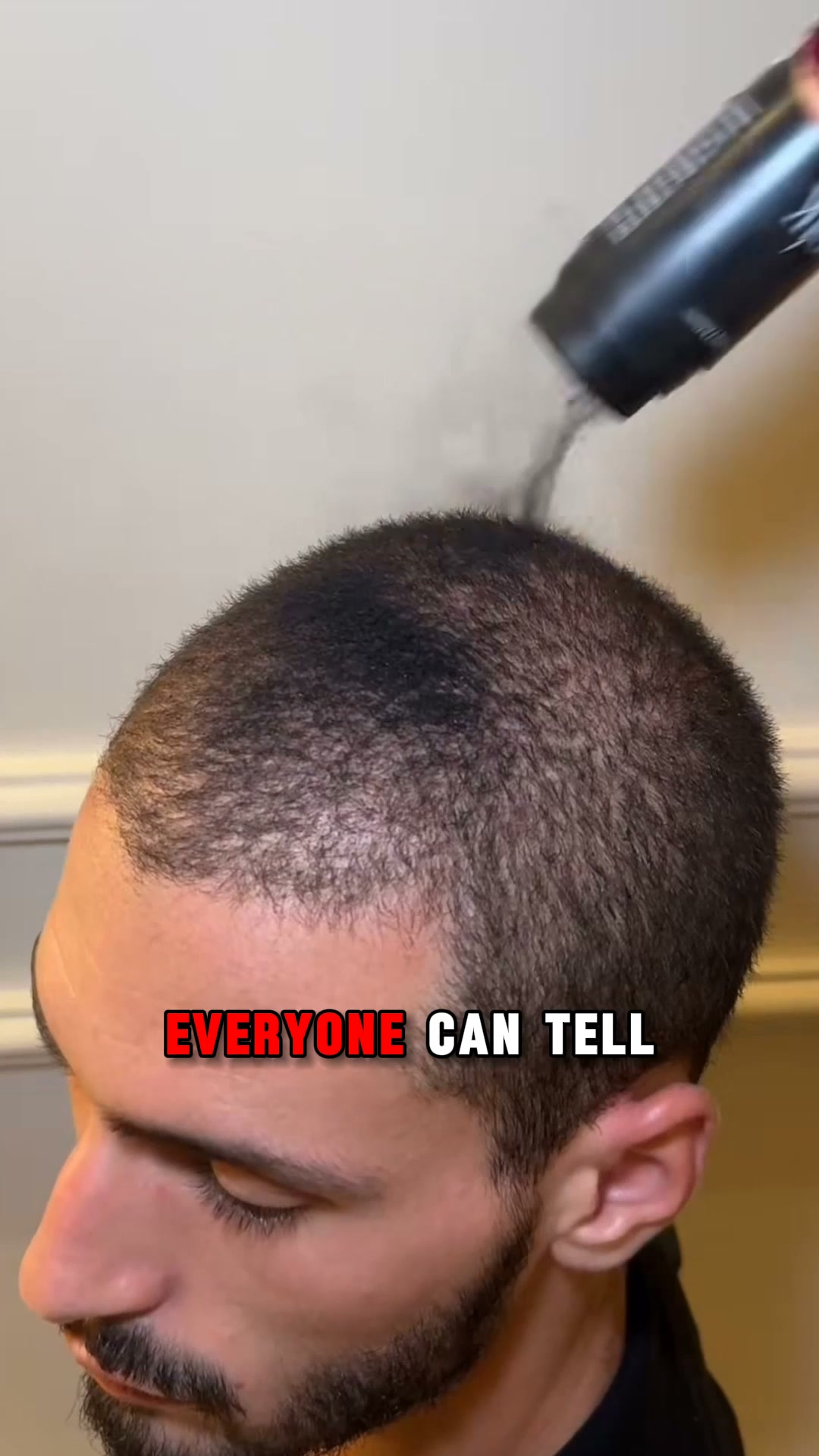 Get Fuller Hair Nobody Can Spot