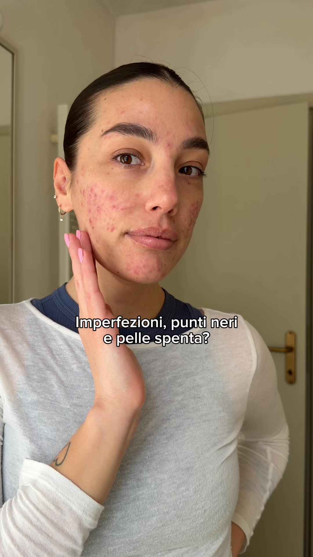 Stop imperfezioni e punti neri