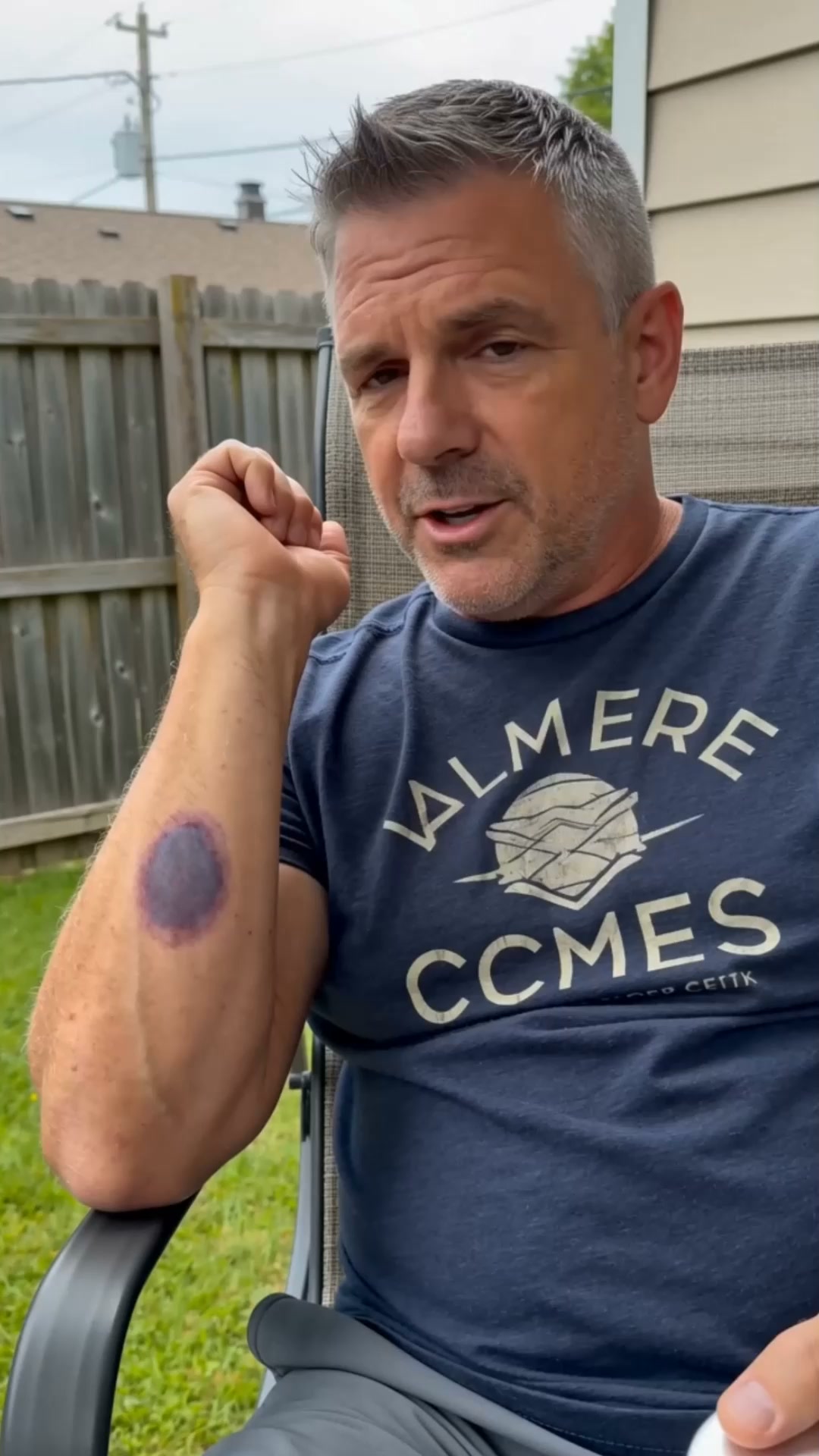 Small Bumps Can Leave Big Marks — Care Daily