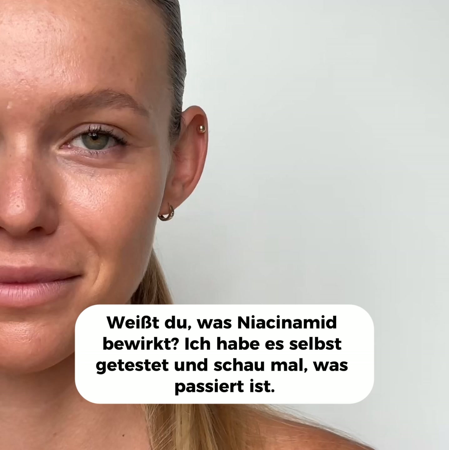 15 % Niacinamid in einem Serum. Reguliert den Talg, gleicht den Teint aus, verfeinert die Poren – ohne Irritationen. Nutridome.