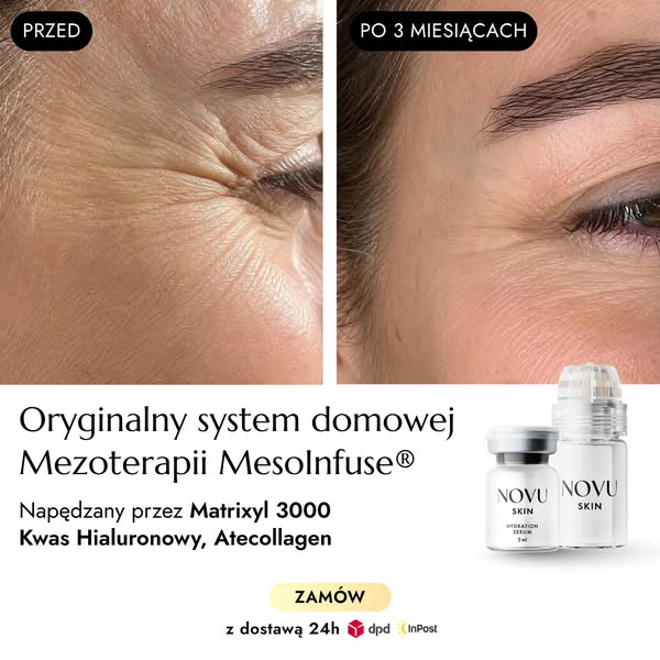 Matrixyl™ 3000 + Atecollagen + HA