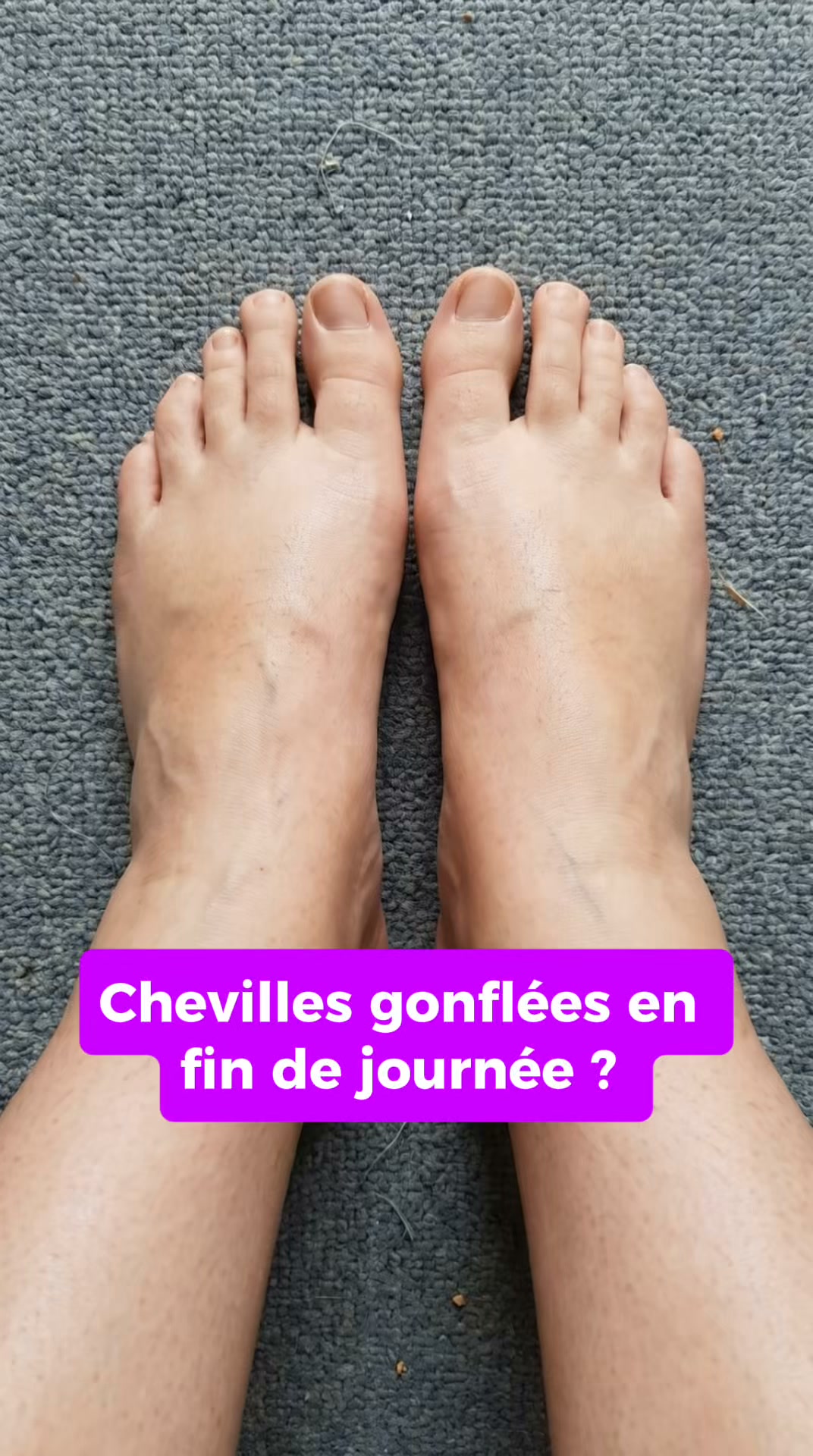 Anti-cellulite N°1 à domicile