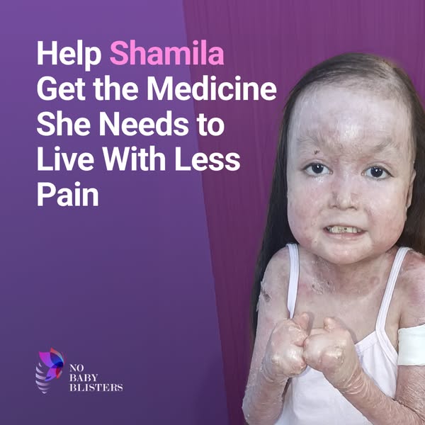 Shamila’s Skin Is Falling Off. Help Her.