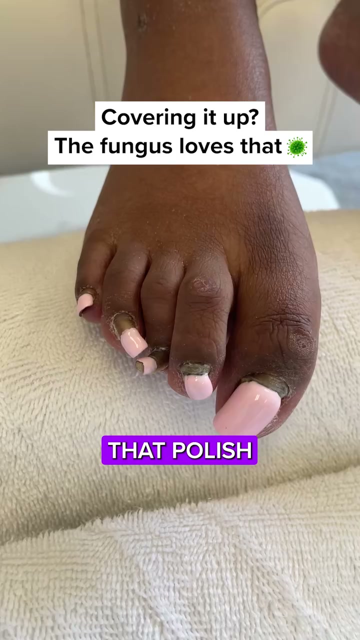 The Real Reason You’re Hiding Feet