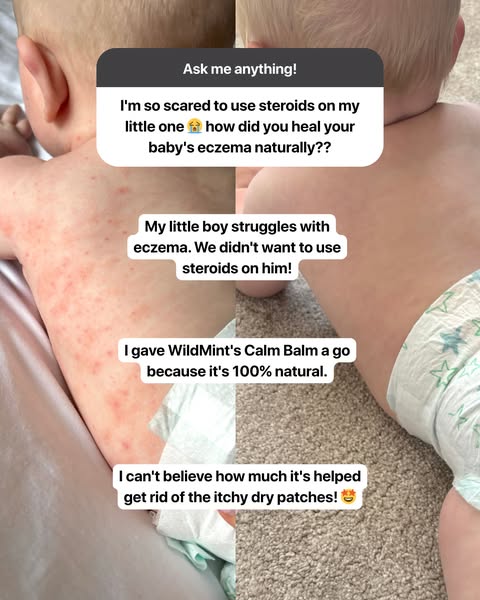 End the Struggle of Sore Skin!