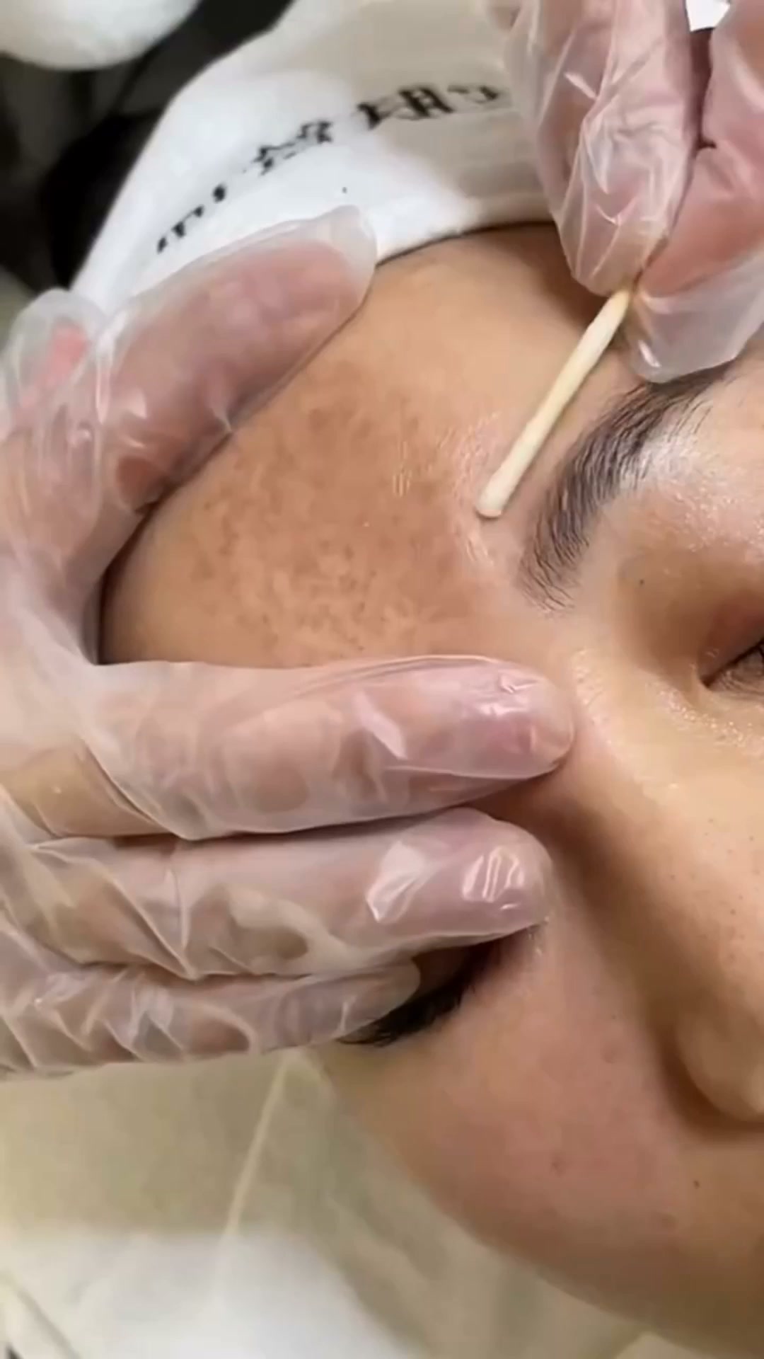 Erase Dark Spots. Reveal Flawless Skin