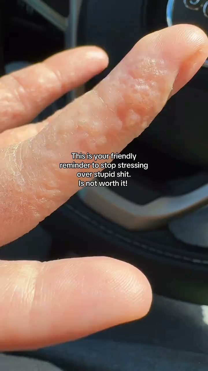 Anúncio de Dr. Azura