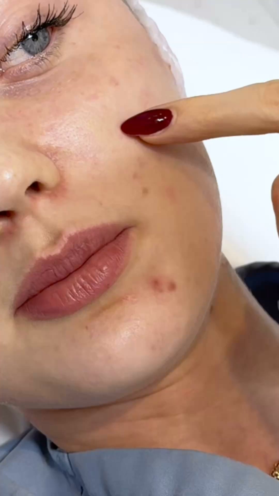 Anúncio de Continental Skin Clinic