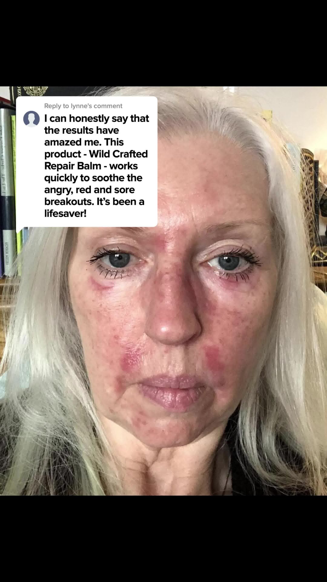 Heathy, stronger skin naturally!