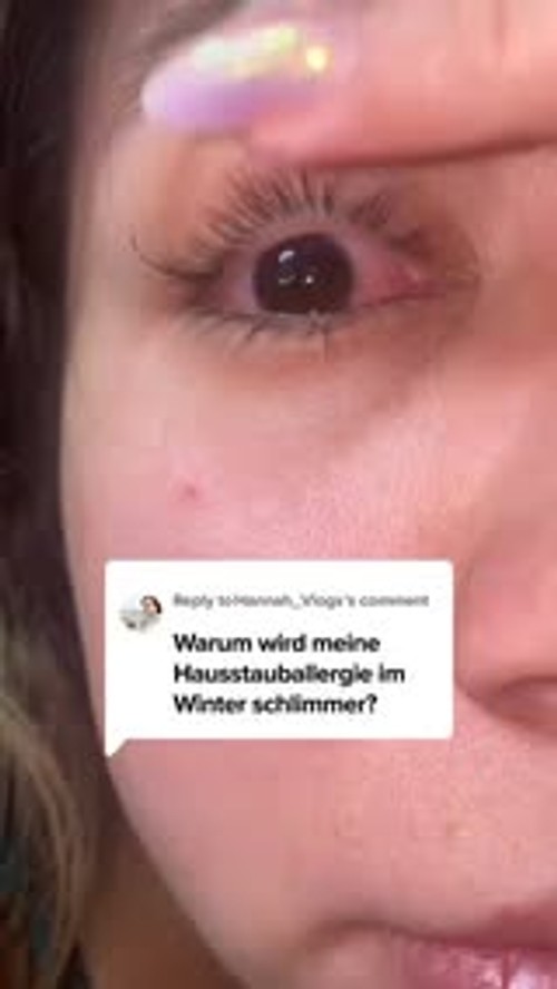 Warum die Allergie im Winter schlimmer wird