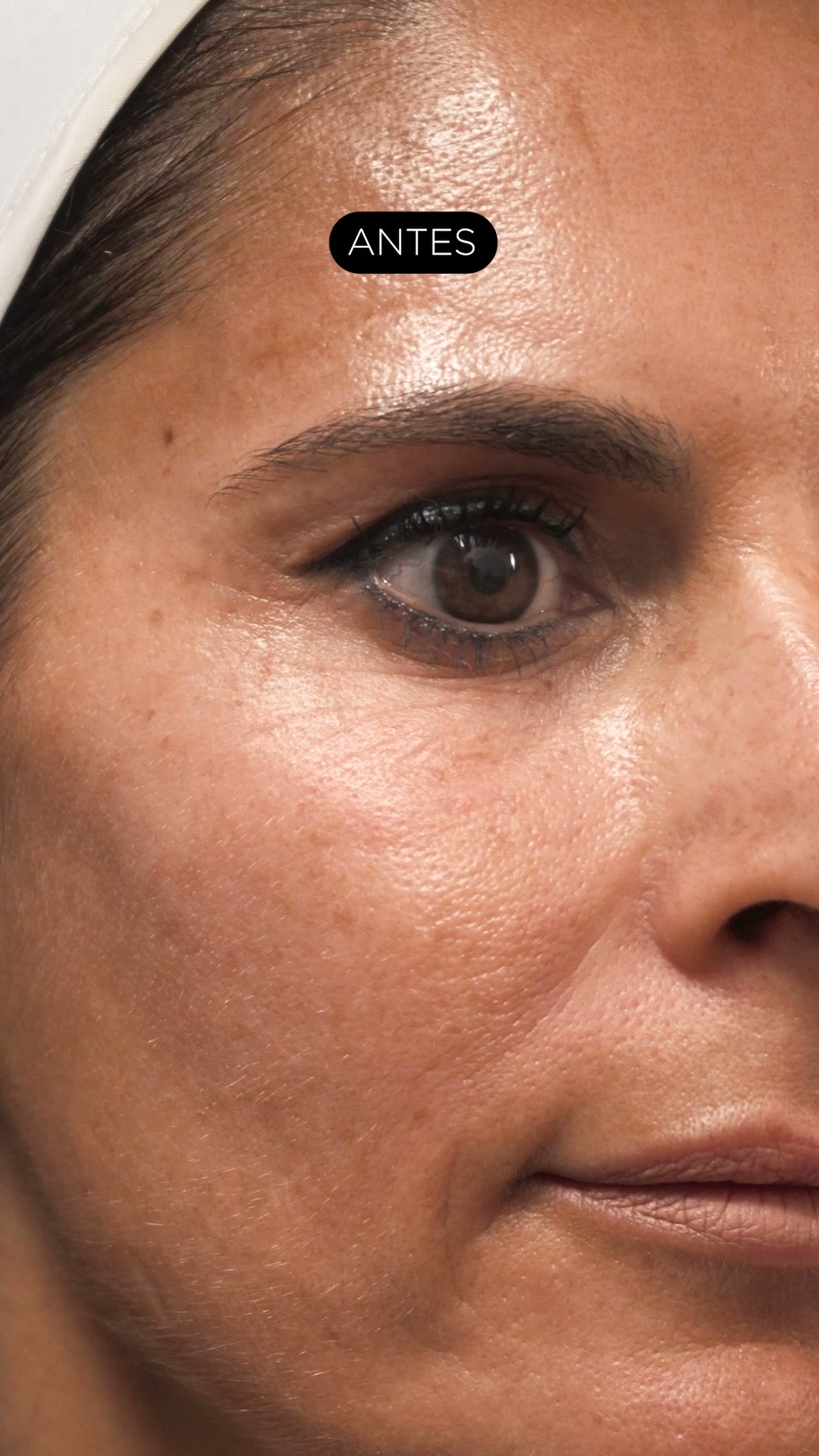 Intracellular Lifting Mask