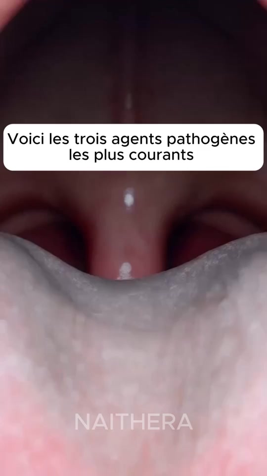 Les 3 coupables de votre mauvaise haleine.