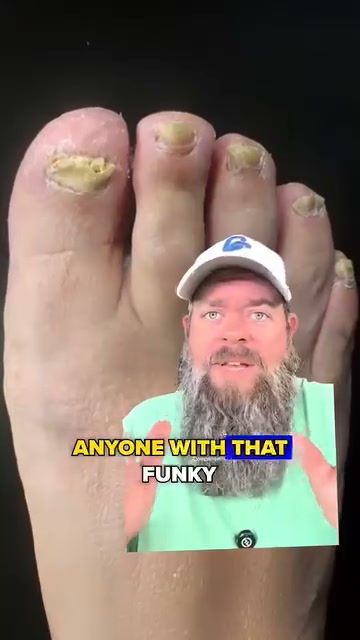 The Real Reason You’re Hiding Feet