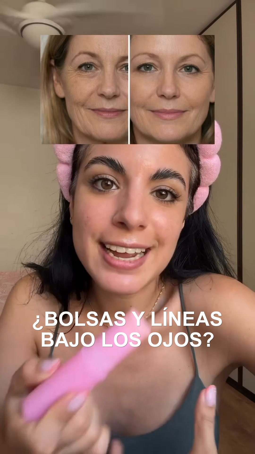 ¿Bolsas y líneas bajo los ojos?