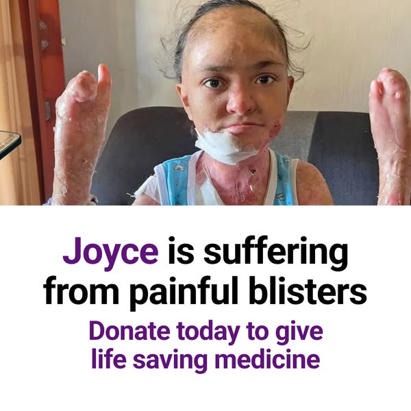 Joyce’s Skin Is Falling Off. Help Her.