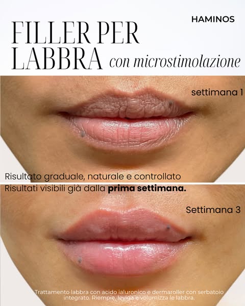 Una nuova routine per le tue labbra