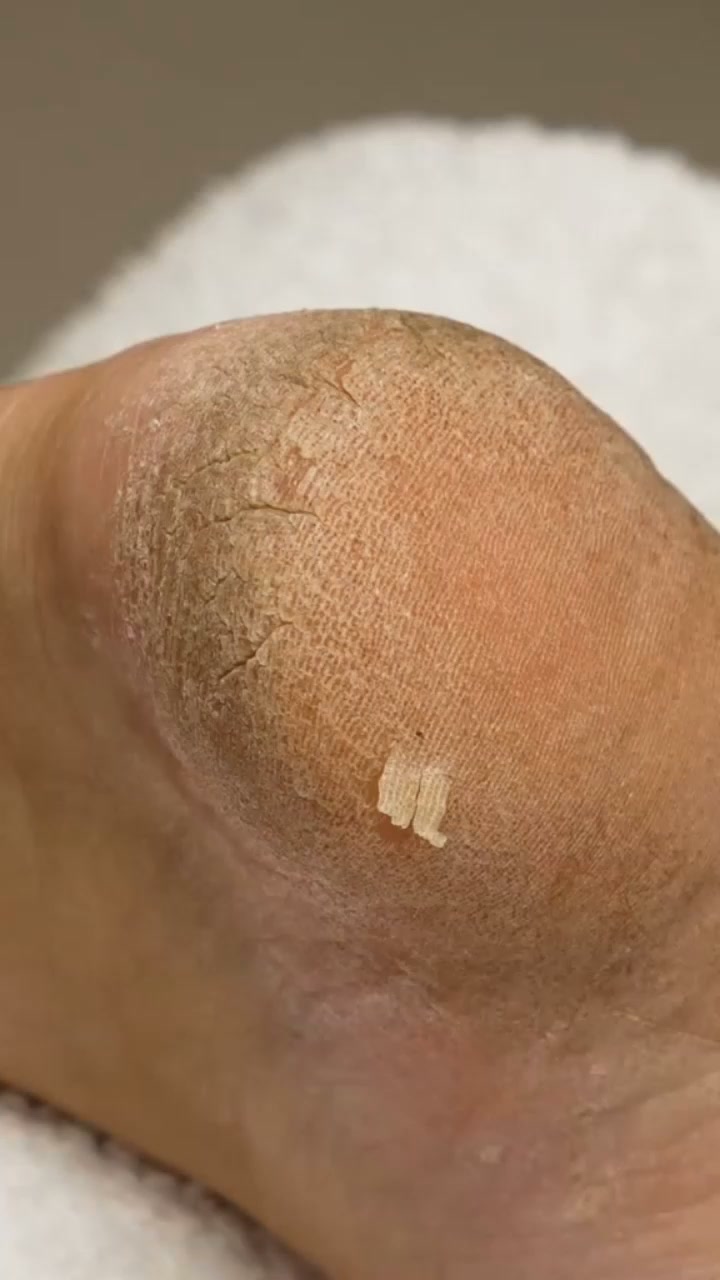 Des pieds de bébé tout doux en 5 minutes chrono