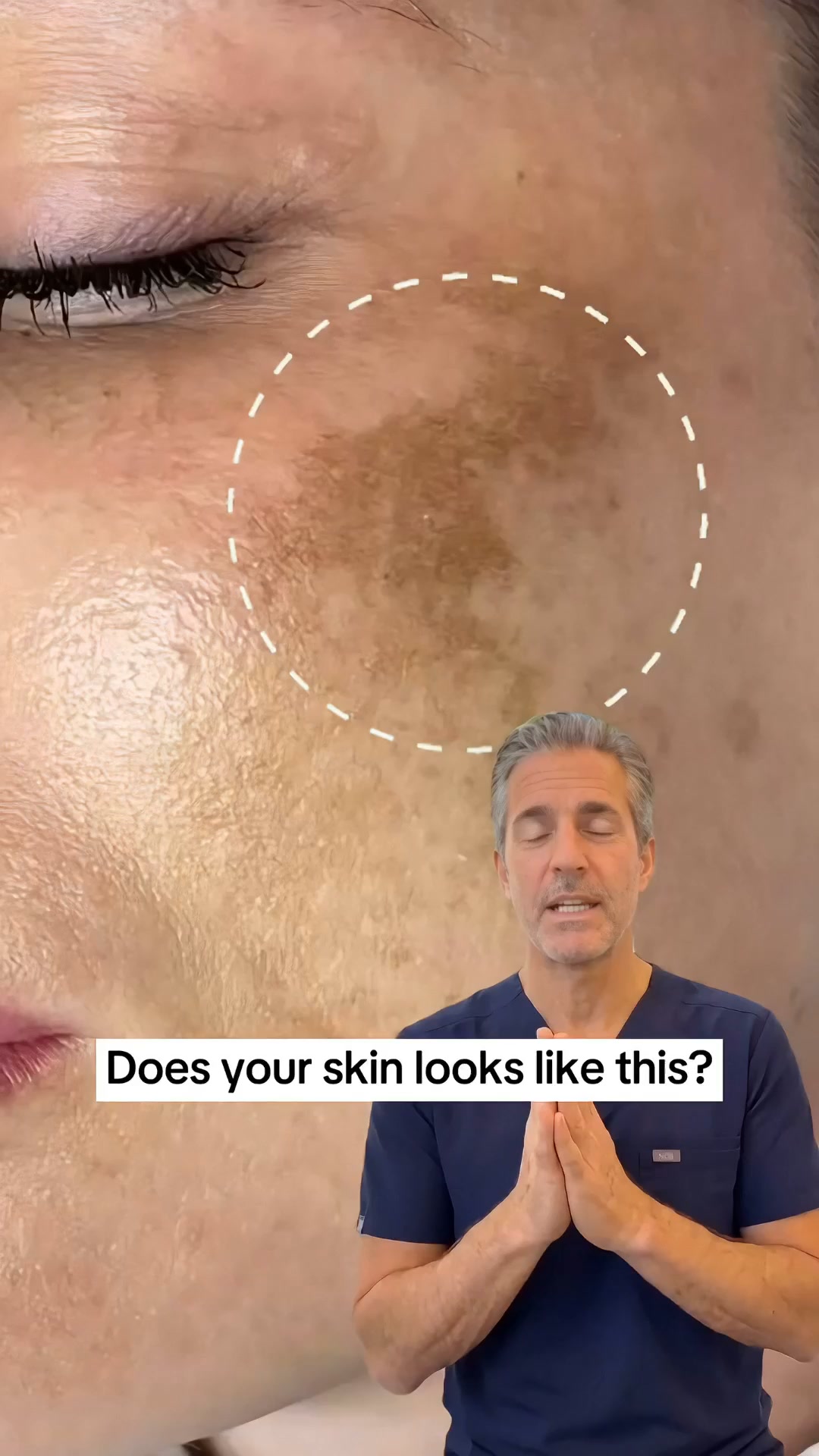 Erase Dark Spots. Reveal Flawless Skin
