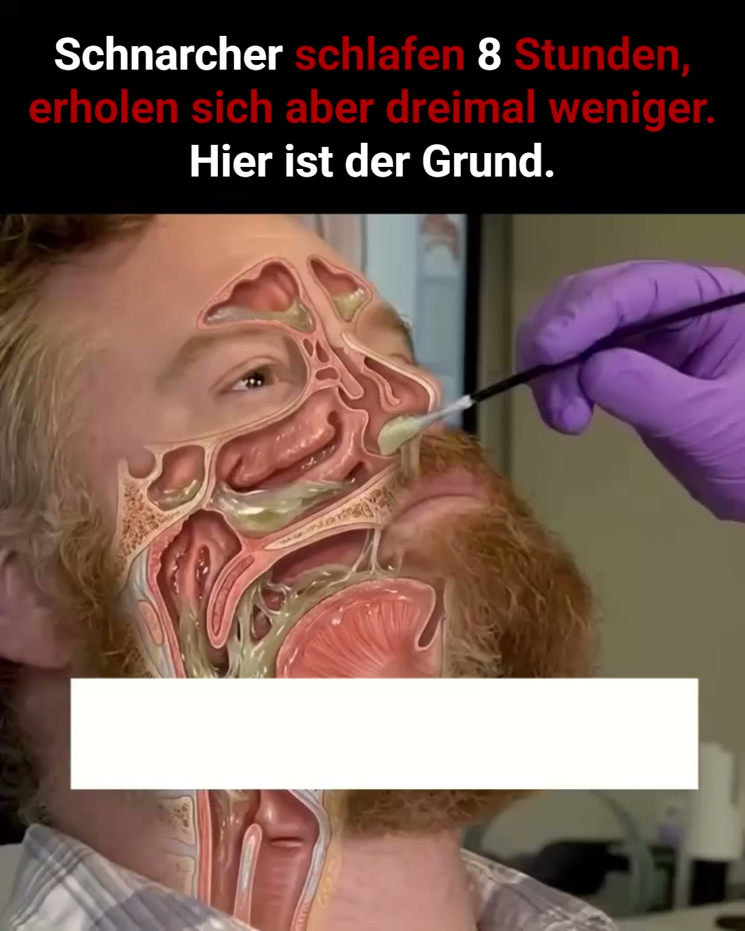 50 % SPAREN