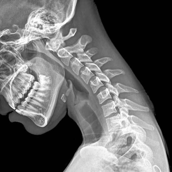 Danevo NiskaRauha™