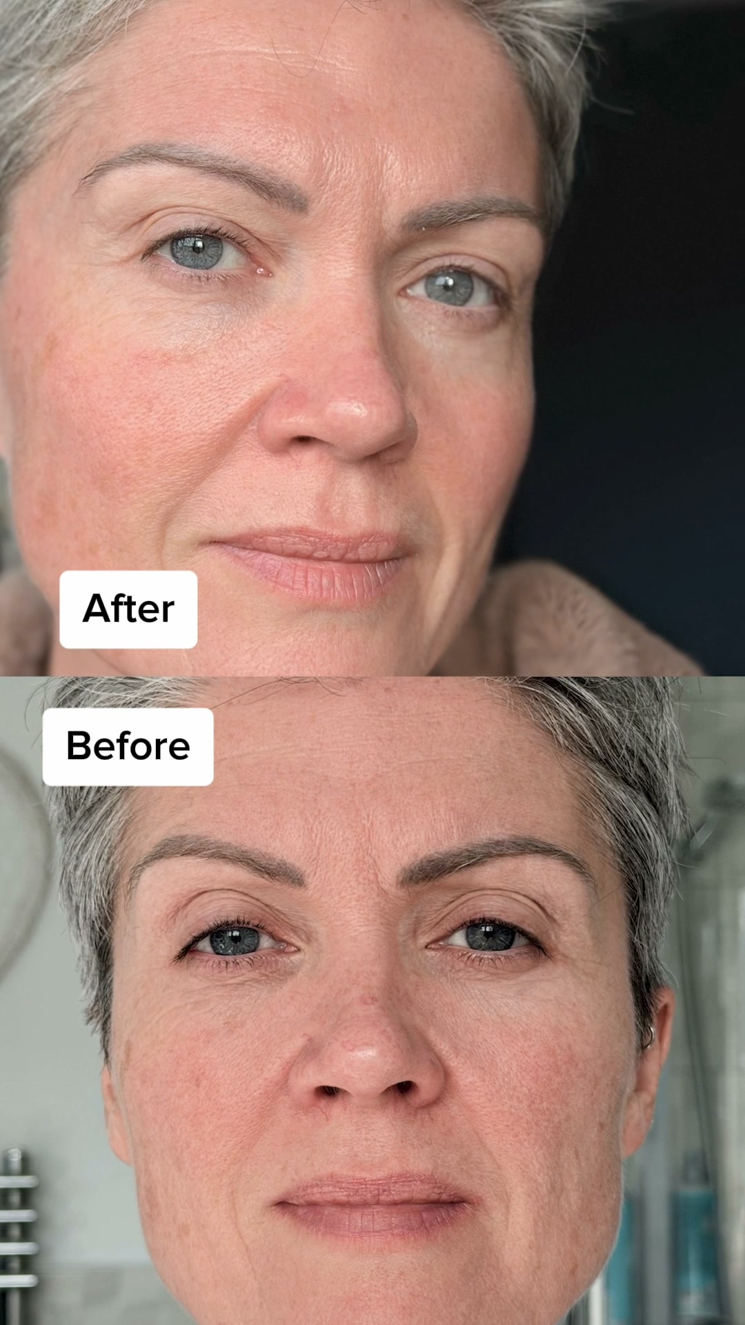 $300 at a clinic, or under $25 at home?