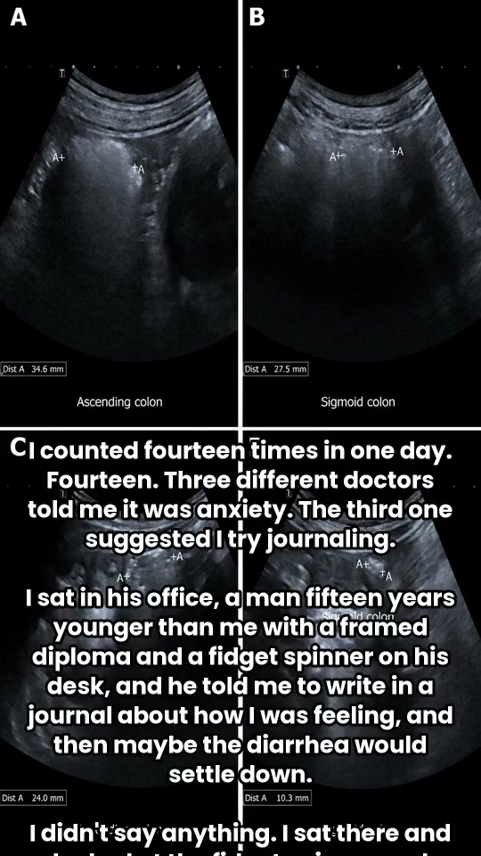 Read if you have IBS