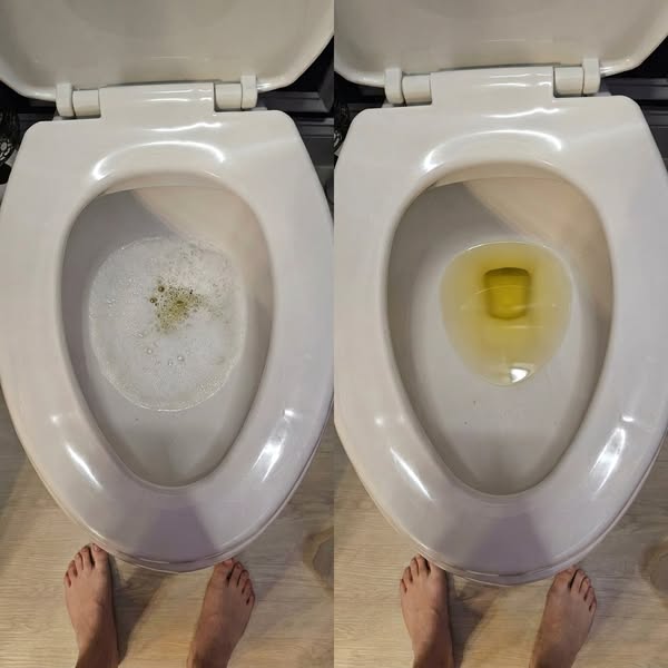 Soffri di glicemia alta?