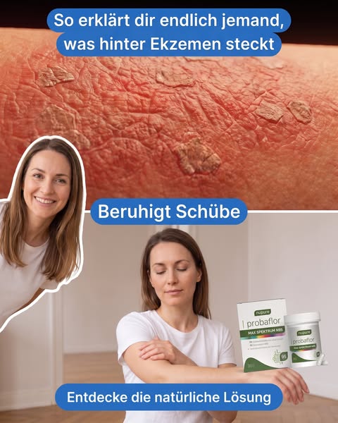 Die Verbindung zwischen Darm und Haut