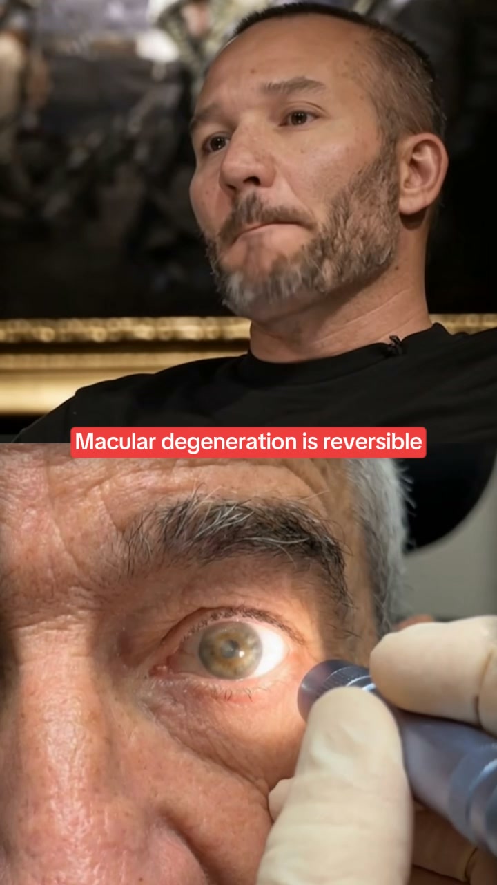 Don’t Blame Your Lifestyle — Fix The Macula Pigment First