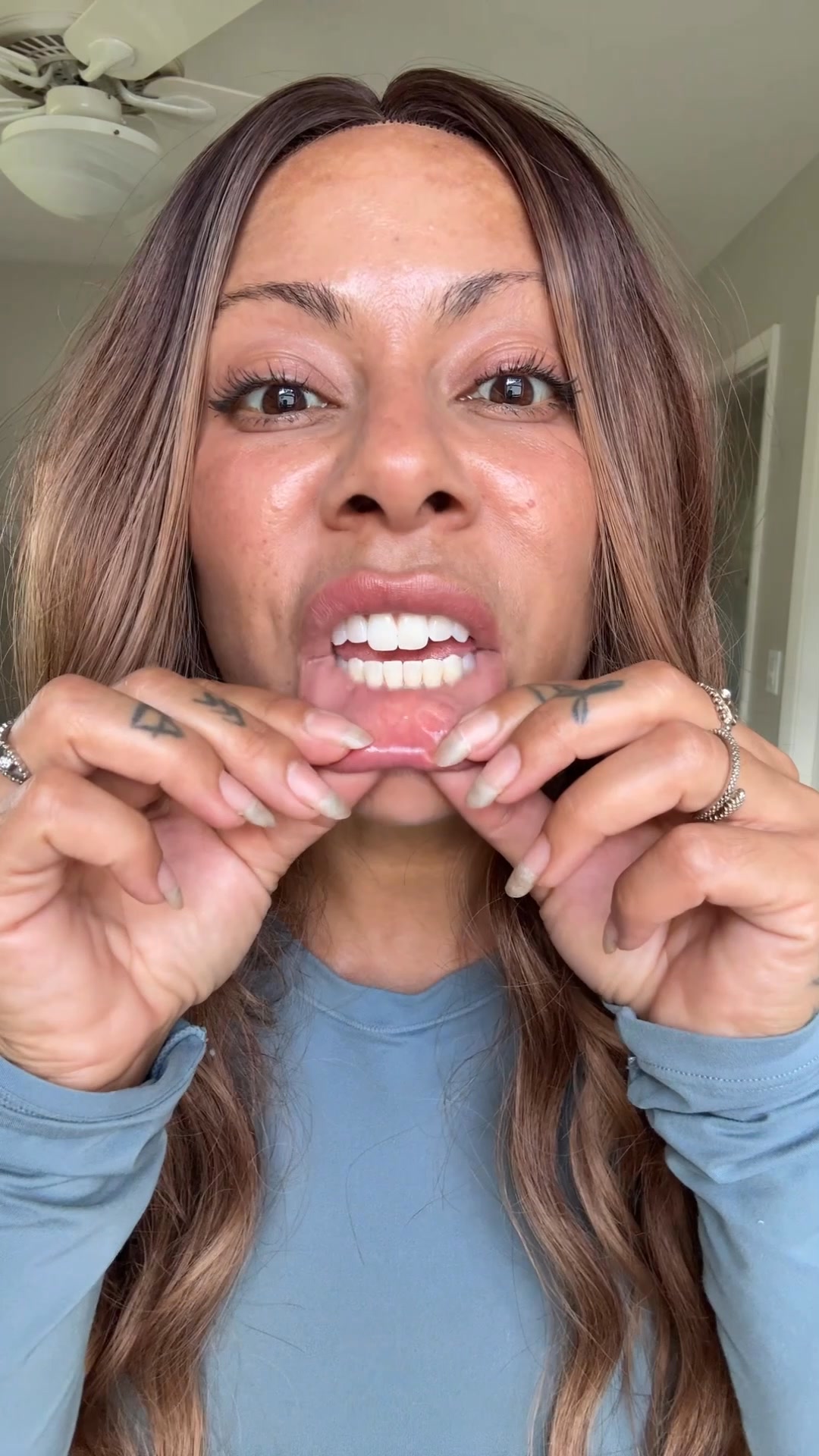 Periodontists Shocked By This Gum Gel — Here's Why